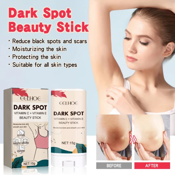 Lightening Body Cream Remove Dark Spots Melanin Bleaching Elbow Armpit Leg Knee Hips Thigh Moisturizing Whitening Underarm Stick