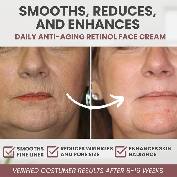 Instant Retinol Cream Wrinkle Remover Firming Lifting Anti Aging Fade Fine Lines Moisturizing Whitening Korea Repair Skin Care - Image 5