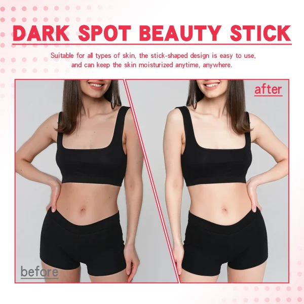 Lightening Body Cream Remove Dark Spots Melanin Bleaching Elbow Armpit Leg Knee Hips Thigh Moisturizing Whitening Underarm Stick - Image 4