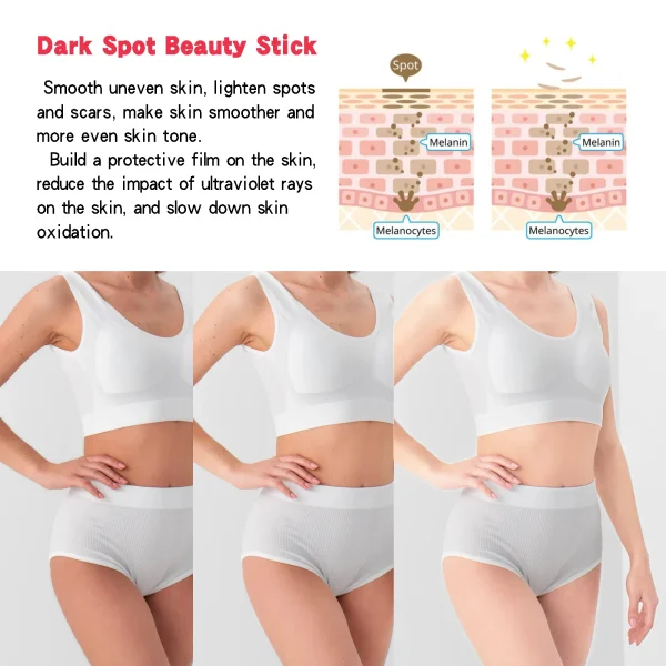 Lightening Body Cream Remove Dark Spots Melanin Bleaching Elbow Armpit Leg Knee Hips Thigh Moisturizing Whitening Underarm Stick - Image 2