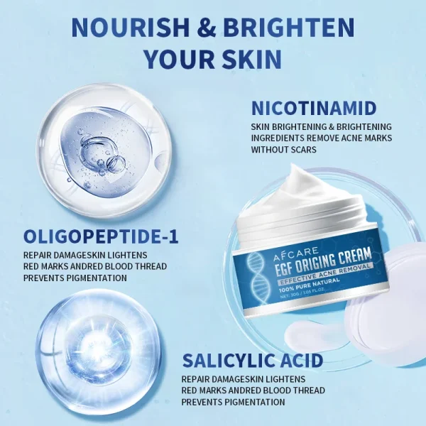 Acne Cream Salicylic Acid Oligopeptides Repair Acne Marks Spots Deep Cleansing Pores Oil Control Moisturizing Skin Care Products - Image 3