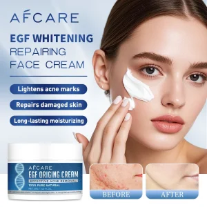Acne Cream Salicylic Acid Oligopeptides Repair Acne Marks Spots Deep Cleansing Pores Oil Control Moisturizing Skin Care Products