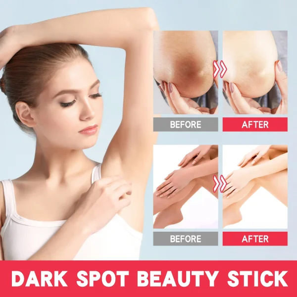 Lightening Body Cream Remove Dark Spots Melanin Bleaching Elbow Armpit Leg Knee Hips Thigh Moisturizing Whitening Underarm Stick - Image 3