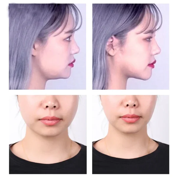 40-120PCS V-Shape Face Wrinkle Sagging Skin Adhesive Tape Lifting Face Stickers Invisible Transparent Thin Face Patche Lift Tool - Image 5