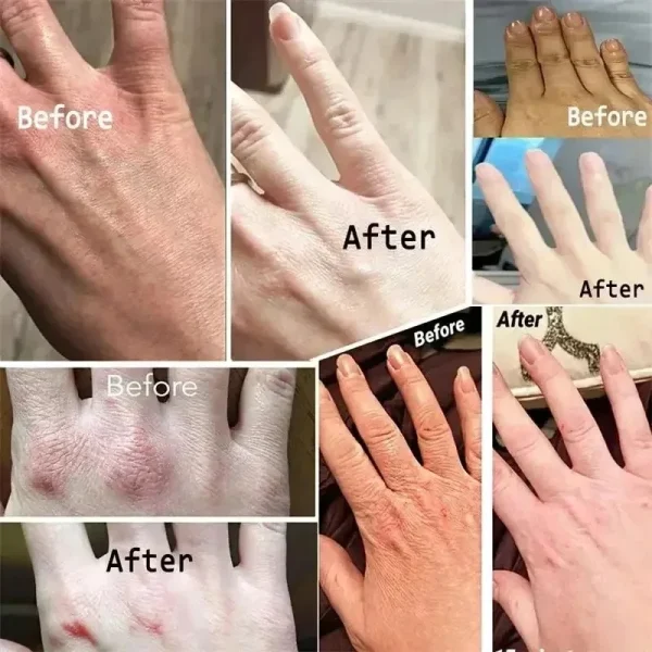 Kojic Acid Cream Fade Dull Hand Body Fast Smooth Nourish Lotion Lightening Dark Skin Brightening Moisturizing Bleaching Cream - Image 6
