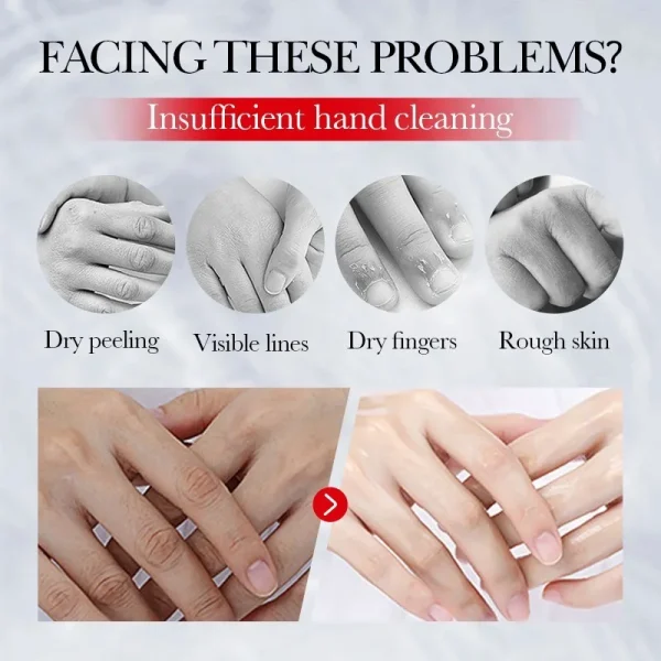 Kojic Acid Cream Fade Dull Hand Body Fast Smooth Nourish Lotion Lightening Dark Skin Brightening Moisturizing Bleaching Cream - Image 2