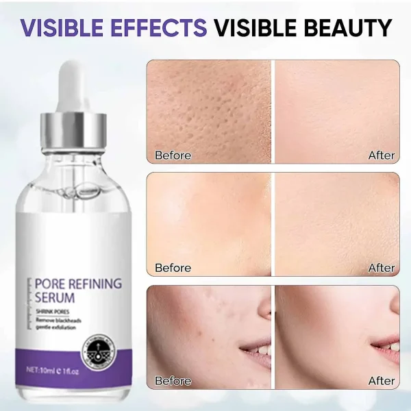 Pore Shrinking Serum Face Removing Large Pores Tightening Repairing Facial Pore Minimizing Essence Skin Care Beauty Firm skin - Image 6